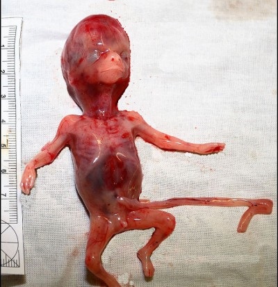 Абортированный 12-недельный ребенок