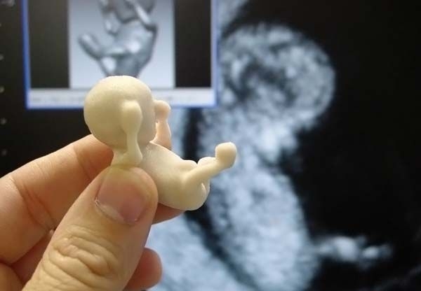 Муляж 12-недельного ребенка. Задний план фото с монитора УЗИ 12-недельного ребенка во чреве матери