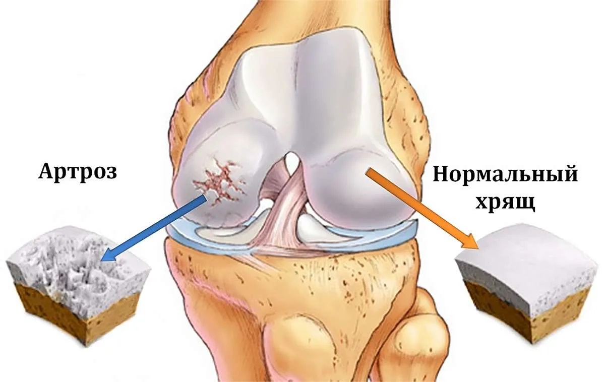     -    30  ,     2 - 3 .      ,         .   5    ,   
