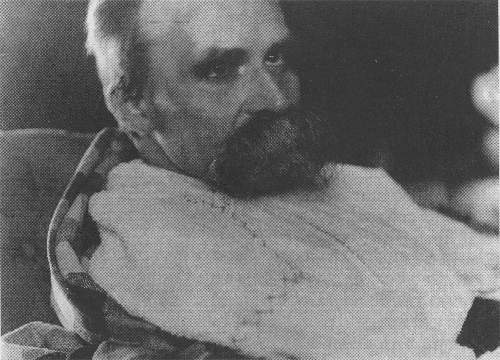 Фридрих Ницше в психиатрической клинике, 1899 год